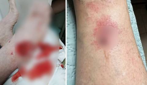 Ataque de cães em ruas de Iúna traz medo e preocupação a moradores da cidade