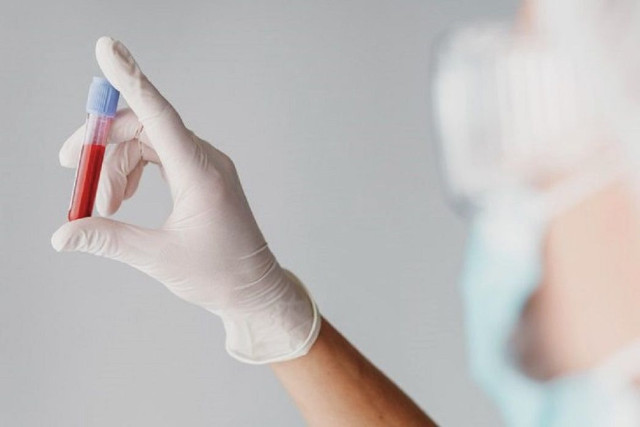 Hantavírus: casos em cruzeiro reacendem alerta sobre transmissão e prevenção