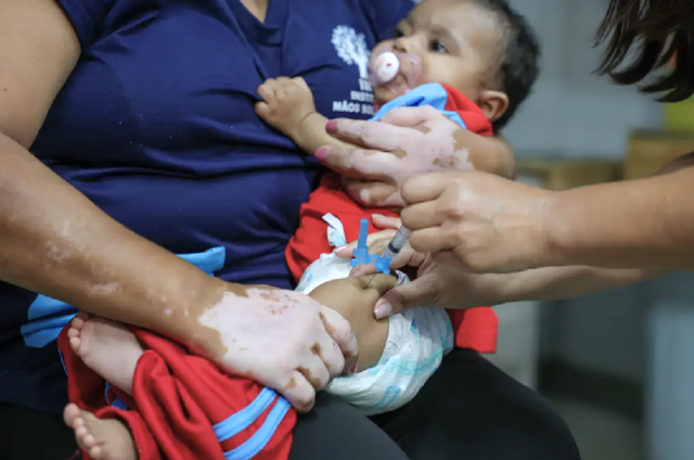 Brasil reduz em quase 90% número de crianças sem primeira dose da vacina pentavalente